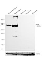 MYH2 Antibody in Western Blot (WB)