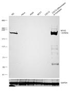 MYH2 Antibody in Western Blot (WB)