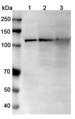 TRPM4 Humanized Antibody in Western Blot (WB)