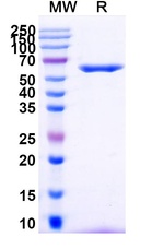 TRAIL-R2 (DR5) Humanized Antibody in SDS-PAGE (SDS-PAGE)
