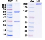Adintrevimab Humanized Antibody in SDS-PAGE (SDS-PAGE)