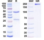 SARS-CoV-2 Spike Protein RBD (Casirivimab Biosimilar) Antibody in SDS-PAGE (SDS-PAGE)