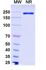 B7-H3 (CD276) (Ifinatamab Biosimilar) Antibody in SDS-PAGE (SDS-PAGE)