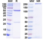 Staphylococcus aureus Protein A (Omodenbamab Biosimilar) Antibody in SDS-PAGE (SDS-PAGE)