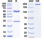 Tirnovetmab Antibody in SDS-PAGE (SDS-PAGE)
