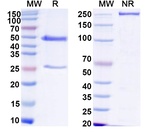 Human IgG1 Isotype Control in SDS-PAGE (SDS-PAGE)