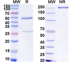 Human IgG2 Isotype Control in SDS-PAGE (SDS-PAGE)