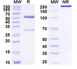 Human IgG2 lambda Isotype Control in SDS-PAGE (SDS-PAGE)