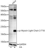 Phospho-MYL2 (Thr18) Recombinant Rabbit Monoclonal Antibody (8X1X2)