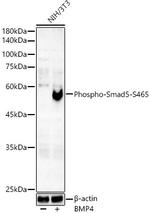 Phospho-SMAD5 (Ser465) Recombinant Rabbit Monoclonal Antibody (2Q7T2)