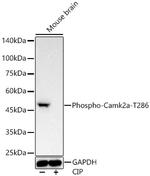Phospho-CaMKII alpha (Thr286) Recombinant Rabbit Monoclonal Antibody (10G8J4)