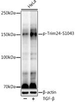 Phospho-TRIM24 (Ser1043) Recombinant Rabbit Monoclonal Antibody (7N5L6)