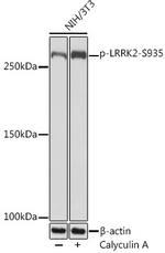 Phospho-LRRK2 (Ser935) Recombinant Rabbit Monoclonal Antibody (4J10Z7)