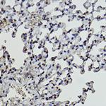 Formyl-Histone H2B (Lys108) Antibody in Immunohistochemistry (Paraffin) (IHC (P))