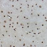 Formyl-Histone H2B (Lys108) Antibody in Immunohistochemistry (Paraffin) (IHC (P))