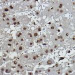 Formyl-Histone H2B (Lys108) Antibody in Immunohistochemistry (Paraffin) (IHC (P))