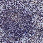 H2BK116me1 Antibody in Immunohistochemistry (Paraffin) (IHC (P))