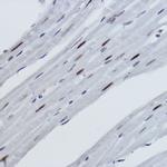 H2BK116me1 Antibody in Immunohistochemistry (Paraffin) (IHC (P))