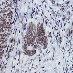 H2BK116me1 Antibody in Immunohistochemistry (Paraffin) (IHC (P))