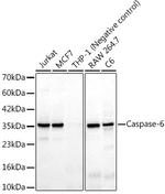 Caspase 6 Recombinant Rabbit Monoclonal Antibody (6F6J5)