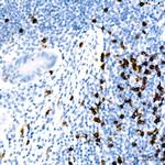 CD8 Antibody in Immunohistochemistry (Paraffin) (IHC (P))