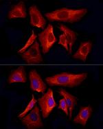 Cytokeratin 8 Recombinant Rabbit Monoclonal Antibody (5K6W6)