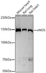 eNOS Recombinant Rabbit Monoclonal Antibody (8W3C2)