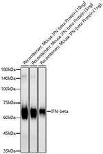 IFN beta Recombinant Rabbit Monoclonal Antibody (1O1F5)