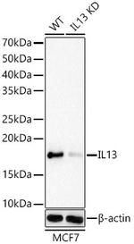 IL-13 Recombinant Rabbit Monoclonal Antibody (2K3U6)