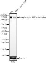 CD49e (Integrin alpha 5) Recombinant Rabbit Monoclonal Antibody (0S9S6)