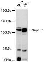 NUP107 Recombinant Rabbit Monoclonal Antibody (8E6H4)