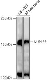 NUP155 Antibody in Western Blot (WB)