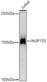 NUP155 Antibody in Western Blot (WB)