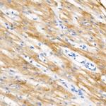 Phospho-Cardiac Troponin I (Ser23, Ser24) Recombinant Rabbit Monoclonal Antibody (9G7R2)