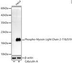 Phospho-MYL2 (Thr18, Ser19) Recombinant Rabbit Monoclonal Antibody (4B2U5)