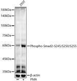 Phospho-SMAD2 (Ser245, Ser250, Ser255) Recombinant Rabbit Monoclonal Antibody (2X1I8)