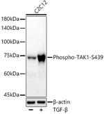Phospho-TAK1 (Ser439) Recombinant Rabbit Monoclonal Antibody (2F4V1)