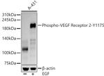 Phospho-VEGF Receptor 2 (Tyr1175) Recombinant Rabbit Monoclonal Antibody (6C7B6)