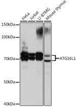 ATG16L1 Recombinant Rabbit Monoclonal Antibody (5N2N9)