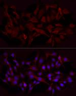 Beclin 1 Antibody in Immunocytochemistry (ICC/IF)