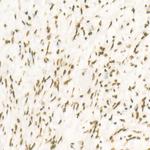 CDK12 Antibody in Immunohistochemistry (Paraffin) (IHC (P))