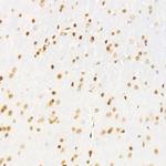 CDK12 Antibody in Immunohistochemistry (Paraffin) (IHC (P))