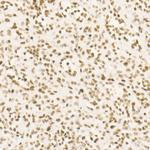 CDK12 Recombinant Rabbit Monoclonal Antibody (9X2D10)