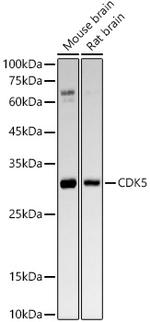 CDK5 Recombinant Rabbit Monoclonal Antibody (6O8F8)