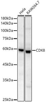 CDK8 Recombinant Rabbit Monoclonal Antibody (2P3P8)