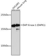 DAPK1 Recombinant Rabbit Monoclonal Antibody (3E10G3)