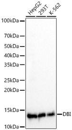 DBI Recombinant Rabbit Monoclonal Antibody (2N0A7)
