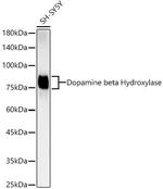 Dopamine beta Hydroxylase Recombinant Rabbit Monoclonal Antibody (1B10B7)