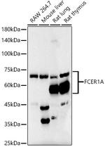 FceR1 alpha Recombinant Rabbit Monoclonal Antibody (7R2U2)