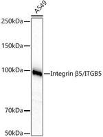 Integrin beta 5 Recombinant Rabbit Monoclonal Antibody (8D2B1)